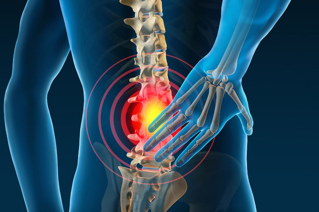Clinical Assessment of Back Pain - Medical Evaluation&nbsp;