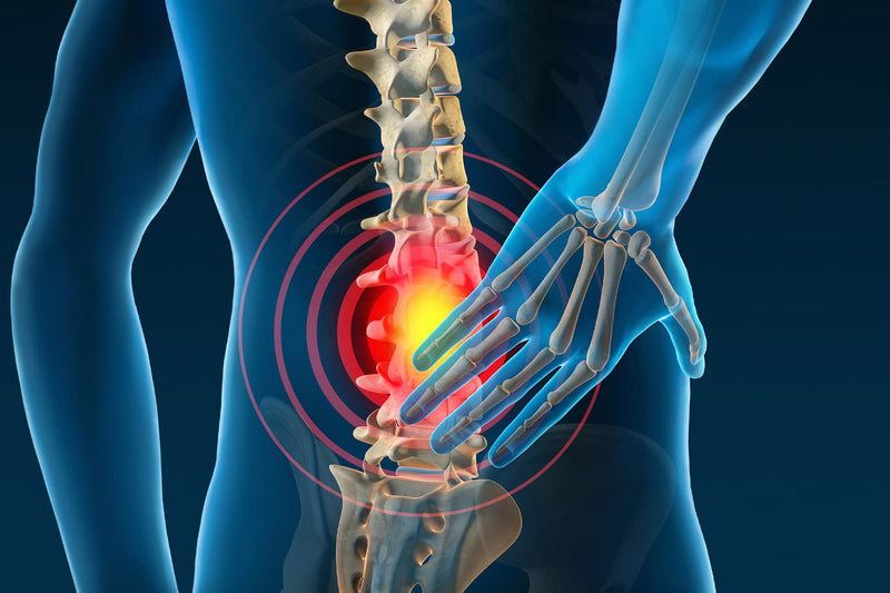 Clinical Assessment of Back Pain - Medical Evaluation&nbsp;