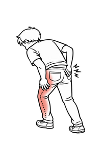 Sciatica Pain Relief